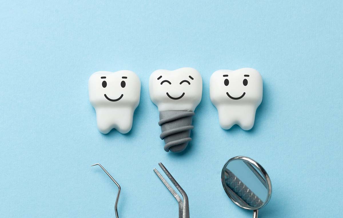 Healthy white teeth and implants are smiling on blue background