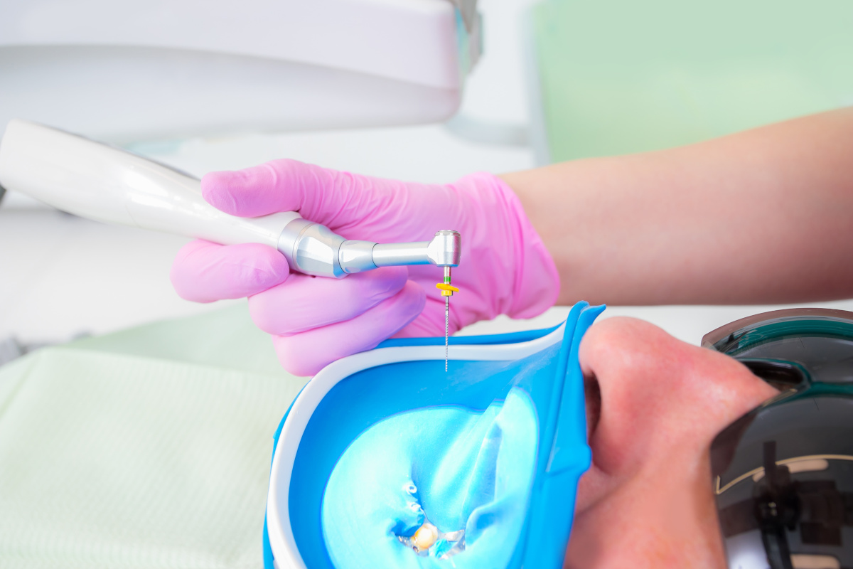 Close up picture of dental instruments: drill and needle for root canal treatment and pulpitis in hand at the dentist in a pink glove