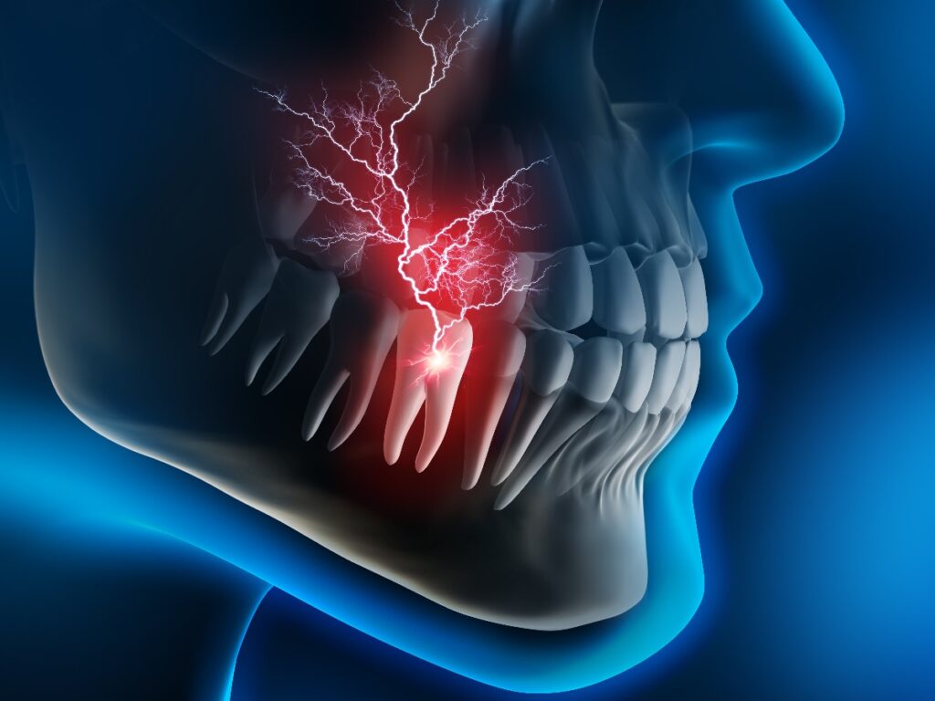 Akute Zahnschmerzen