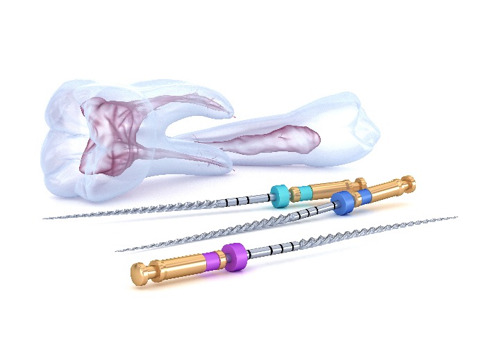 Endodontie Zahnarztwerkzeug