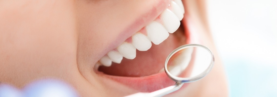 Nahaufnahme einer Frau bei der Untersuchung ihrer Zähne