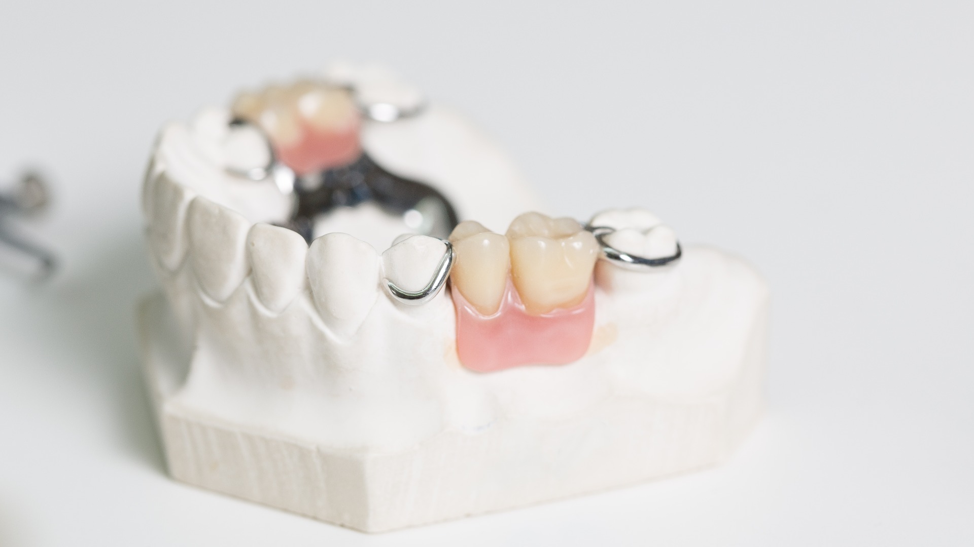 Zahnersatz im Prothesenträger im Dentallabor